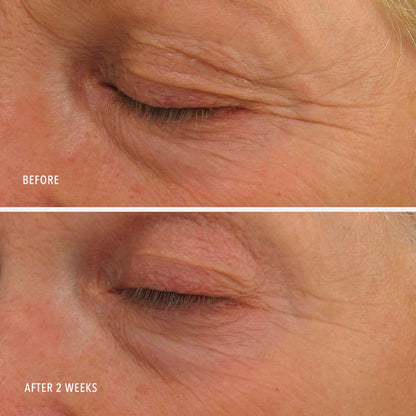 ANAI RUI Retinol+Peptide Eye Cream
