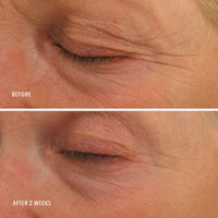 Anti-Aging Peptide + Retinol Eye Cream thumbnail 4